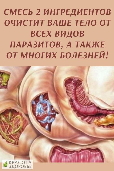 Смесь 2 ингредиентов очистит ваше тело от всех видов паразитов, а также от многих болезней!