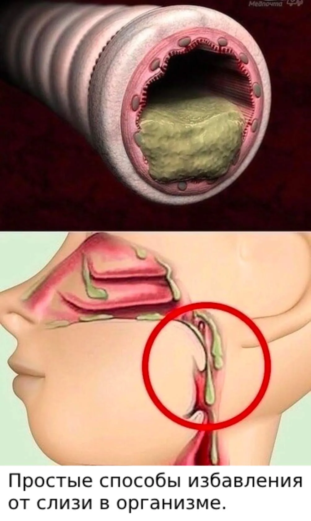 Простые способы избавленияот слизи в организме.